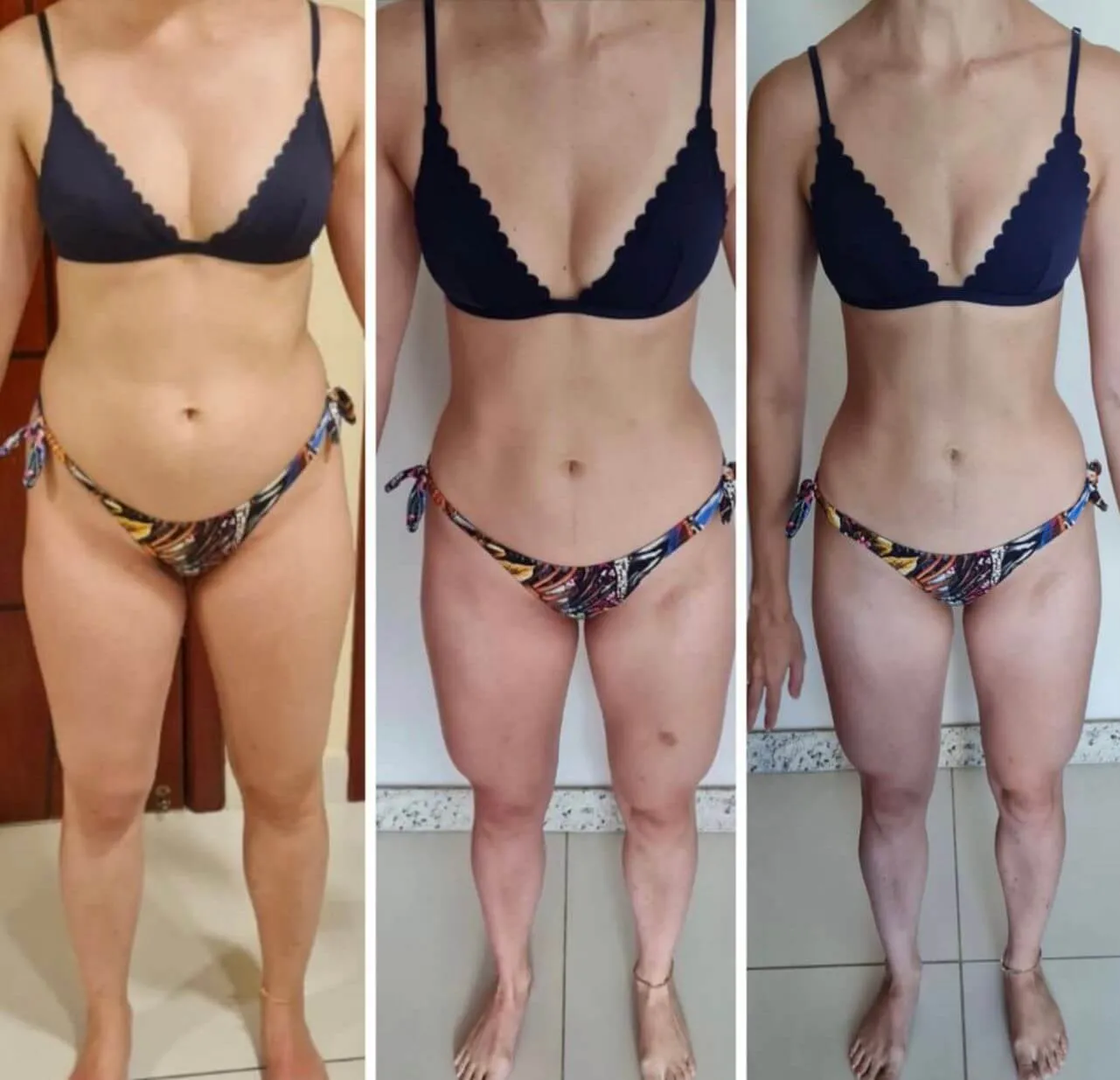 Antes e depois 2